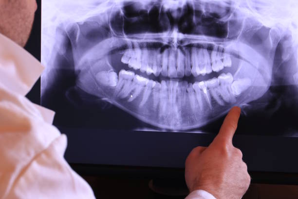 Best Emergency Treatment for Dental Infections or Abscesses in Goldens Bridge, NY